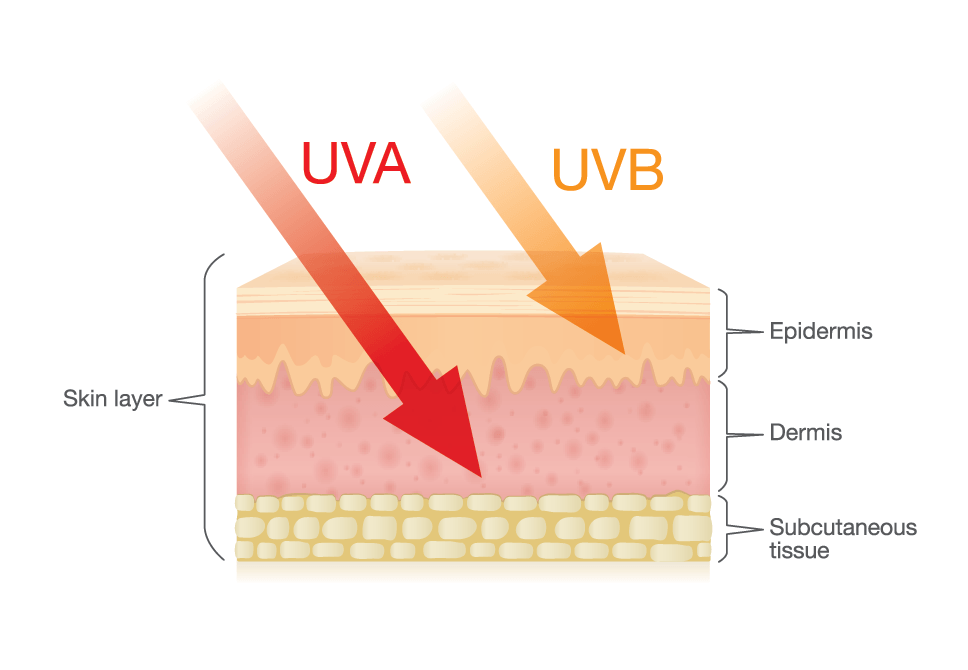 Are You at Risk for Melanoma